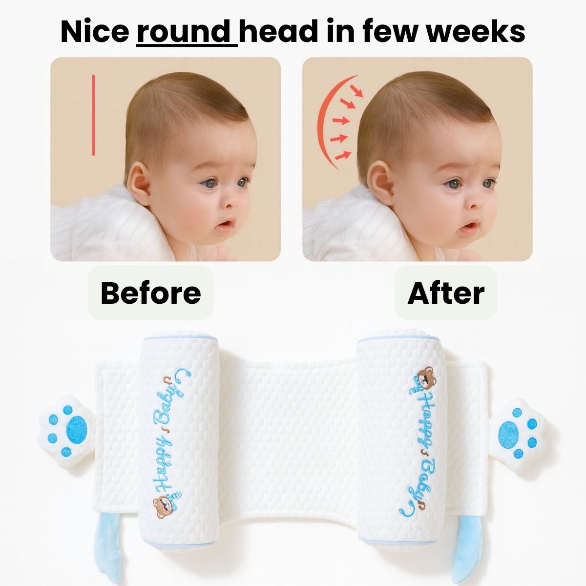 CradleForm - No More Head Tilt. No More Flat Side