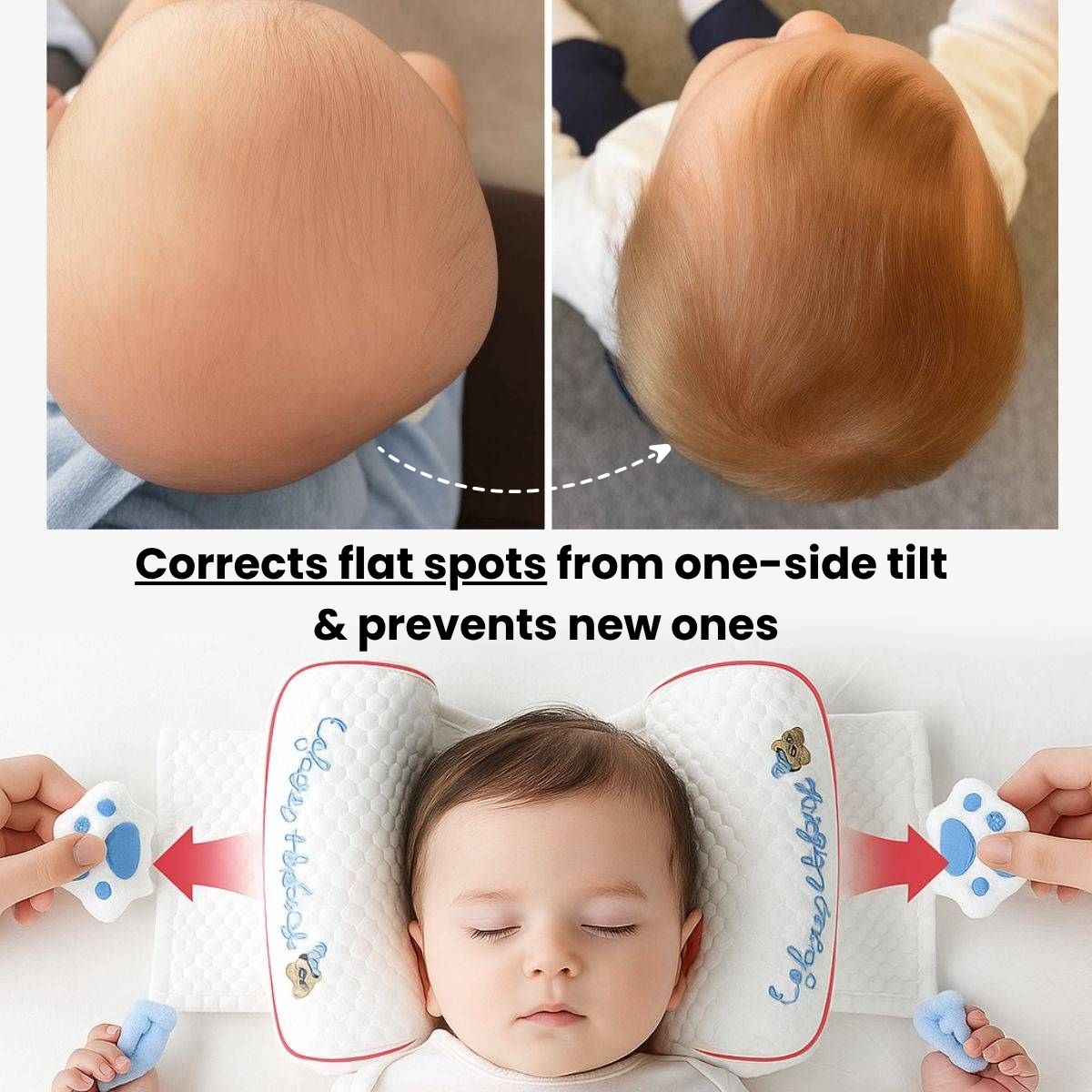 CradleForm - No More Head Tilt. No More Flat Side