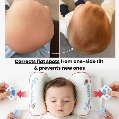 CradleForm - No More Head Tilt. No More Flat Side